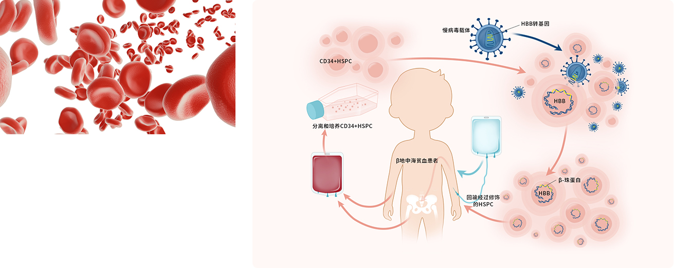 Thalassemia(图1)